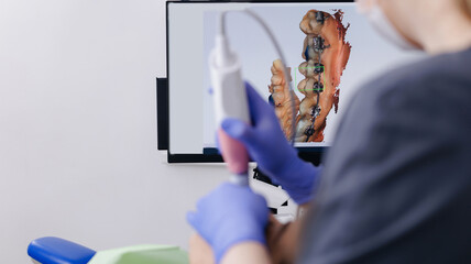 Dentist scanning patient's teeth with braces intraoral 3D scanner in modern clinic