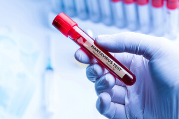 Laboratory worker holding hantavirus blood sample during infectious disease testing
