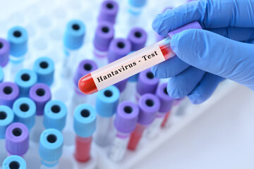 Doctor holding blood sample tube with hantavirus test in clinical laboratory, viral infection diagnostics, epidemiology research and healthcare analysis concept
