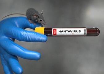 Hantavirus blood test tube in laboratory research and medical analysis setting