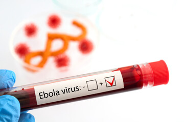 Hand holding blood sample showing positive ebola virus test